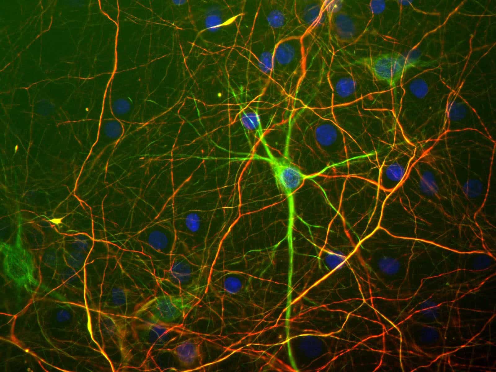 neurons responsible for Habits