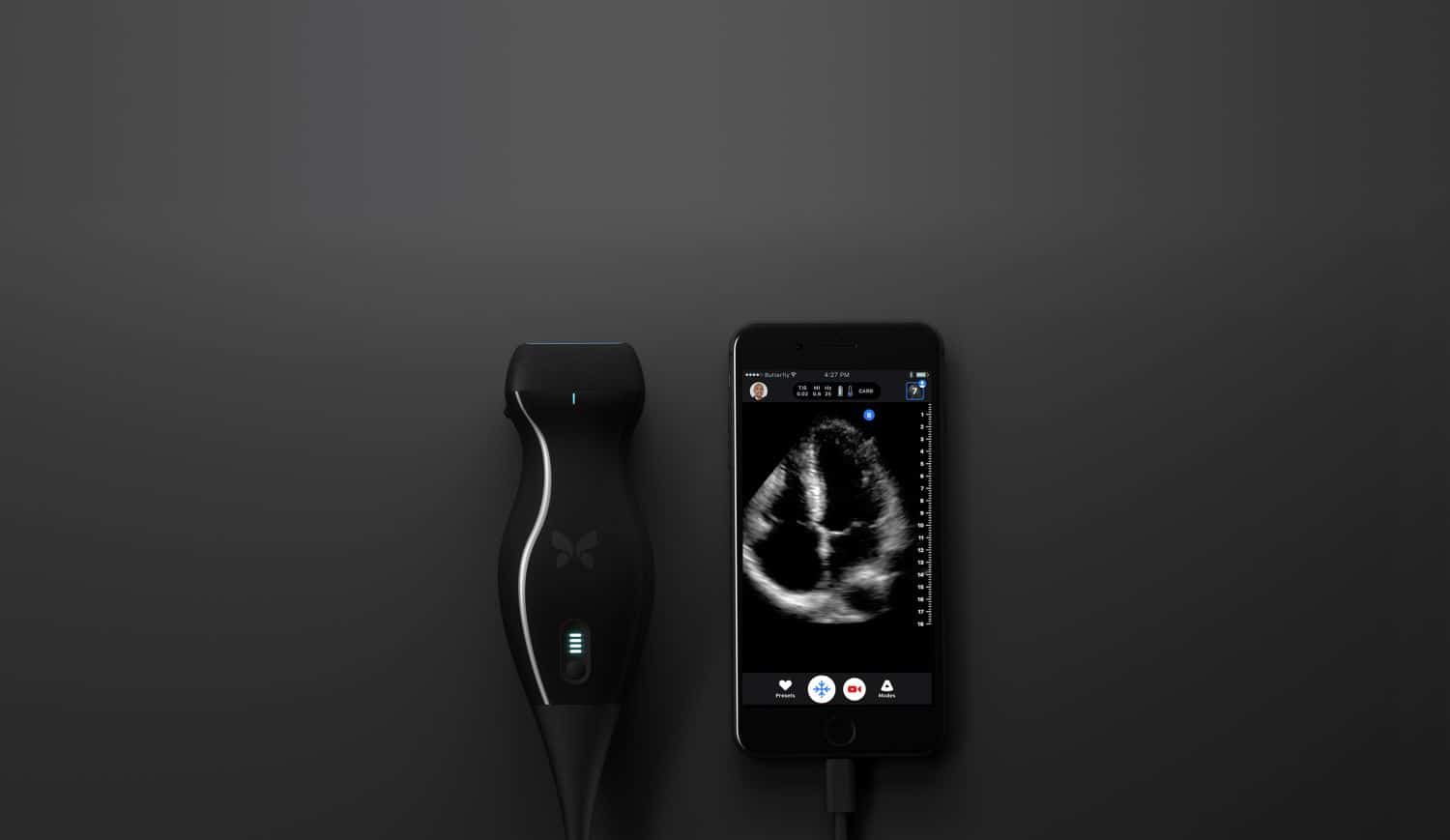 Ultrasound machine with iPhone