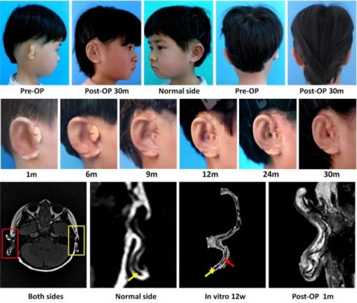 spinonews Chinese scientists made lab grown ears